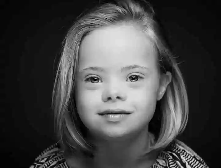 唐氏综合征的儿童有哪方面的障碍