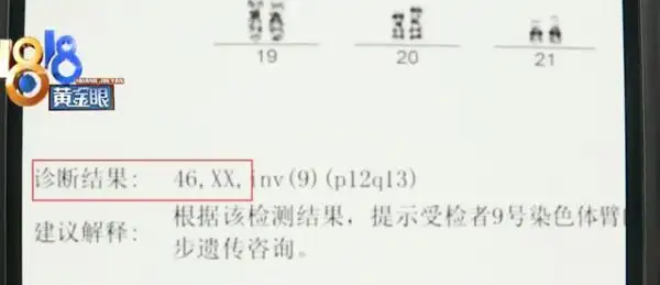 杭州市临平区妇幼保健院检验报告单显示,沈先生的染色体是46xx,与妻子