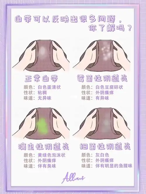 白带可以反映出很多问题你了解吗
