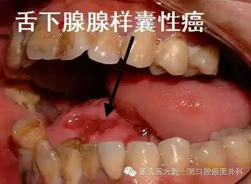 口腔颌面部常见肿瘤图谱