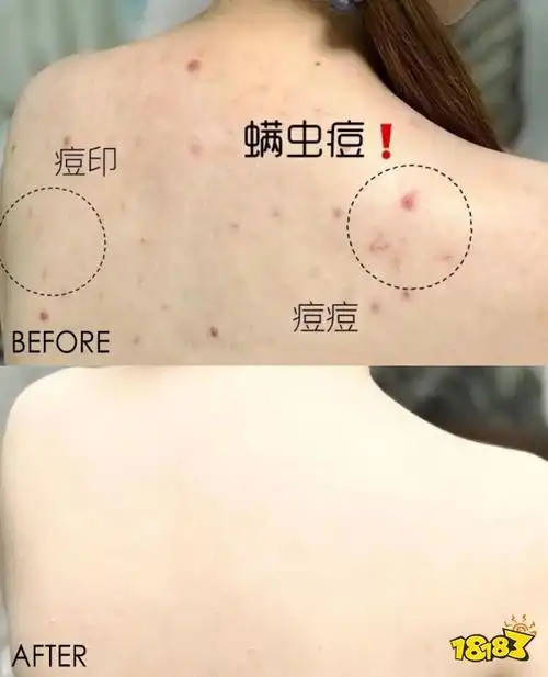 床上喷喷它让千万螨虫集体自杀比太阳暴晒强10000倍