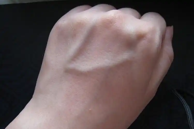 手掌出现青筋图解