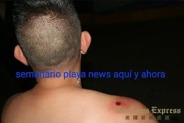 血腥慎点十夜狂欢电子音乐节开火5死15伤