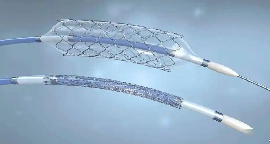 医生不愿用集采支架做手术?回应来了→_心脏_国家组织_患者