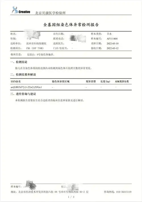 羊水穿刺顺利通过78