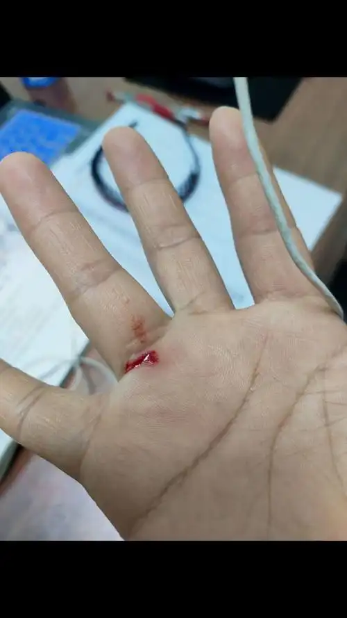 上午不小心把手划破了,我在拍照卖可怜,小甜心却自己从药盒取出了