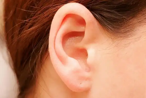 拴马桩耳是什么原因导致的?影响颜值时,是否可以切除
