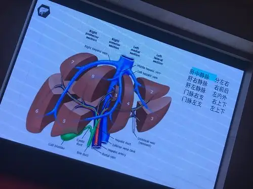肝脏的分叶分段