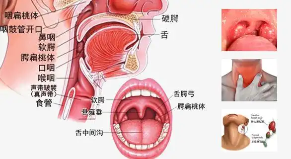 警惕慢性扁桃体炎的这些危害 贵州省第二人民医院耳鼻喉科