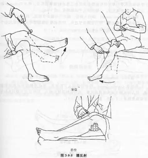 神经系统检查深反射