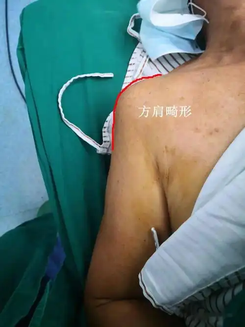 专家教你如何判断