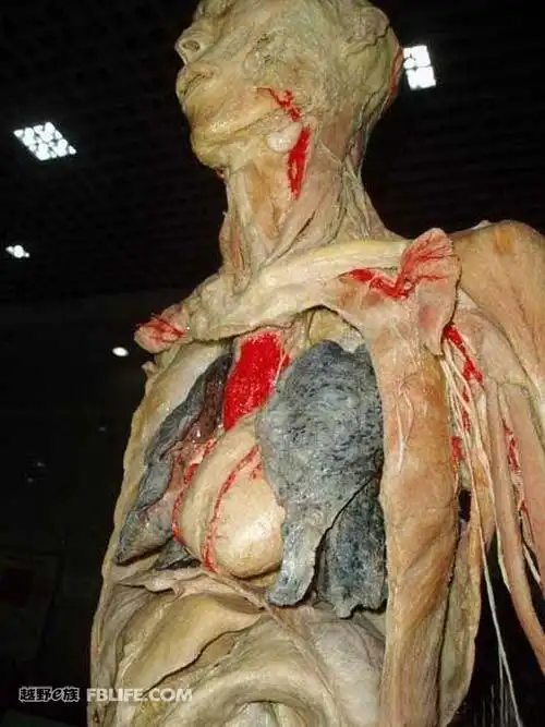 吸烟人快来看自己的肺-医生告诉我们"吸烟人的肺一旦变黑,就不可能