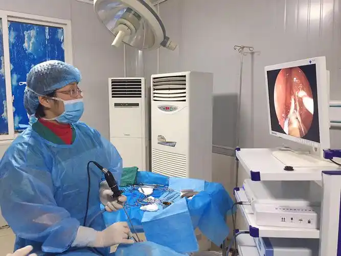 鼻内窥镜系统:无痛可视开展鼻腔,鼻窦手术