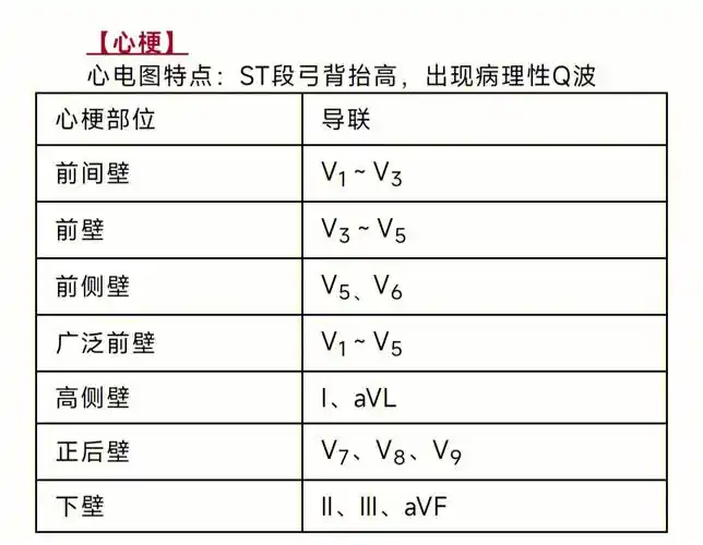 心肌梗死心电图速记