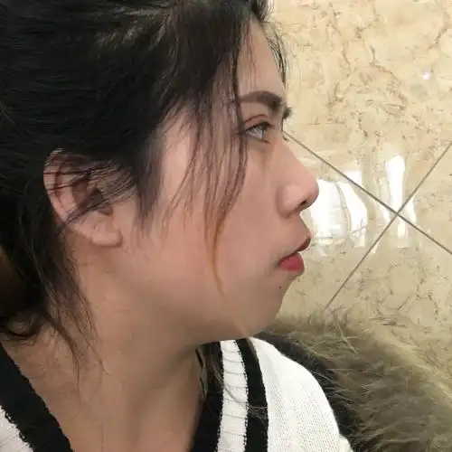 怎么判断牙性凸嘴还是骨性凸嘴