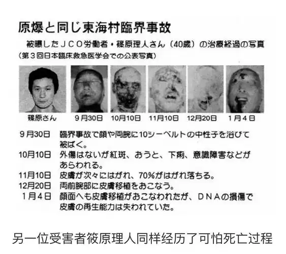 受到核辐射,人会怎样?