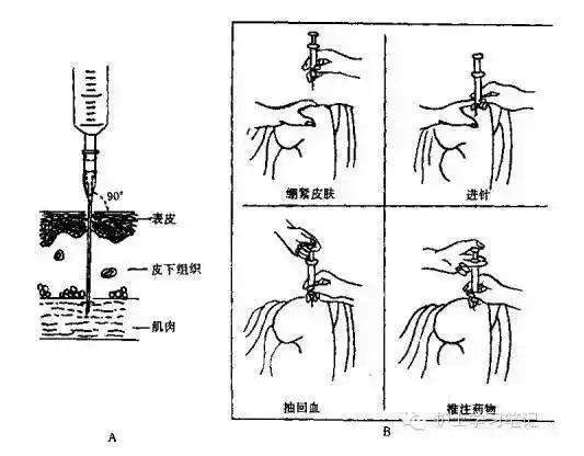 你可能不知道的肌肉注射的3个细节