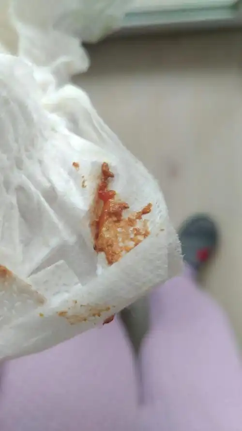 宝宝出生1个月了,以前的便便都是黄色的,今天是黄褐色,还带点丝状物