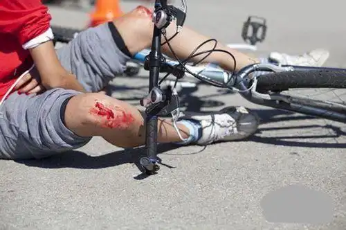 运动中的皮肤擦伤:小问题大麻烦,这些运动紧急处理你要学会