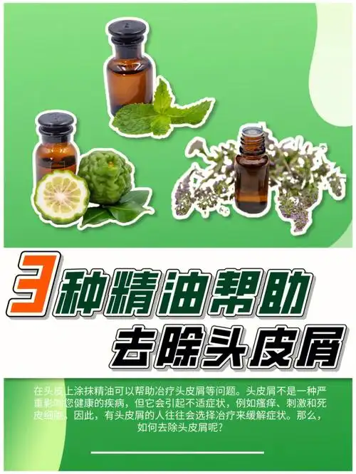 366种精油帮助去除头皮屑