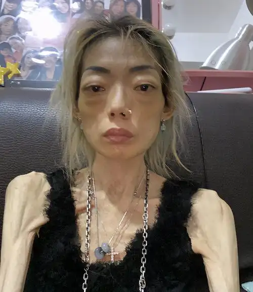 为嫁豪门放弃牛津,今全身瘫痪瘦成"骷髅",她错在了哪里?