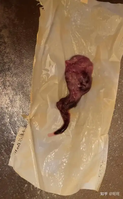 2022打胎药堕胎药货到付款(超详细,历时23天)_健康资讯-幸福起航