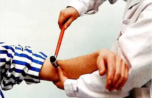 即肌腱反射,主要为肱二头肌反射,膝反射,跟腱反射.