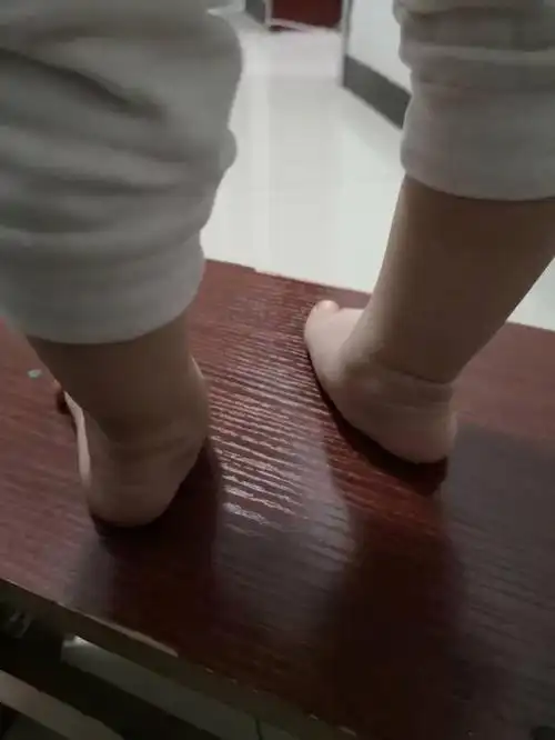 正常婴儿脚后跟图片(什么是足外翻) - 乐宝宝贝