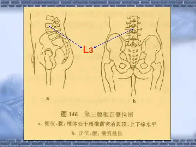 第三腰椎横突综合征(ma)ppt