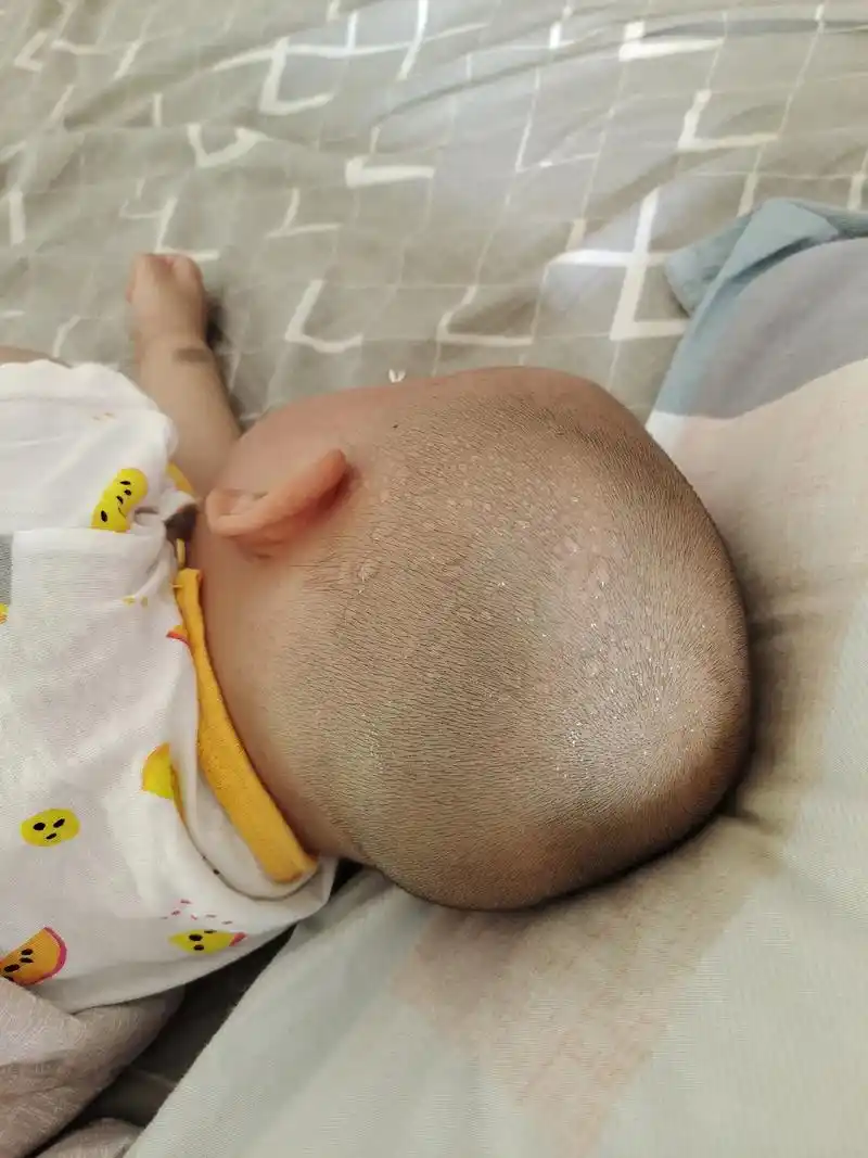 一睡觉就一头汗,身上没有,天冷也这样,不知道是不是从小吃药吃 - 抖音