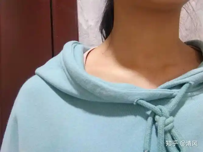 为什么有的人锁骨特别明显,有的人几乎没有?