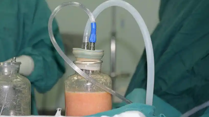 『入珠简介』深圳入珠哪里最专业