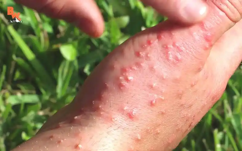 【歪果仁自虐】让火蚁群攻的感觉真爽