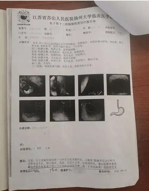 9.11电子胃镜检查结果 食管癌这里看一个真实的病例.文字不多说看图.