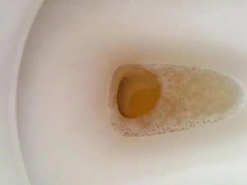 最近两天小便呈现这种颜色请问是怎么回事