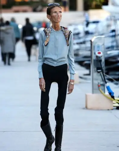 世上最瘦骷髅女valerialevitin坦言不教女孩如何死