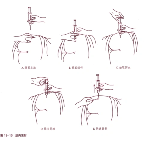 技能操作01肌肉注射