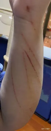 被自己养的猫抓伤了是什么心情?