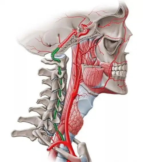椎动脉型颈椎病的治疗(详细解说)