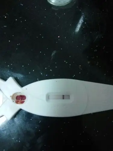 请问艾滋病这个检验结果是阴性还是阳性