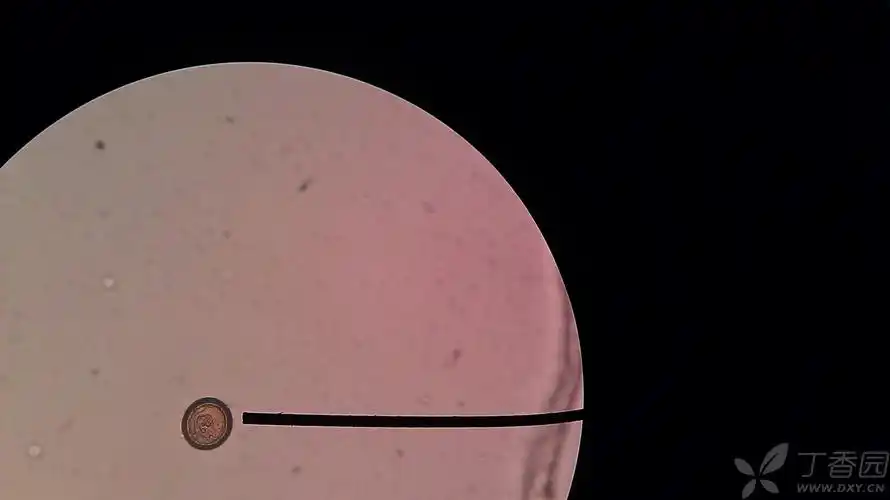 丁香园论坛 - 专业医生社区,医学,药学,生命科学,科研学术交流