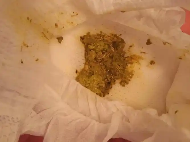 宝宝拉蛋花样粑粑正常吗?