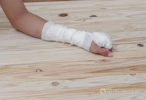 纱布绷带的手挫伤治疗病人