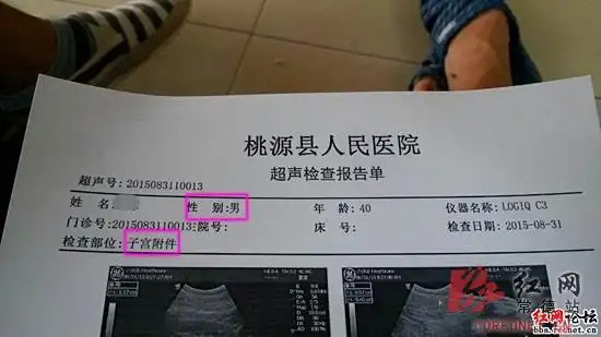 常德男子做b超检查双肾 体内惊现"子宫"