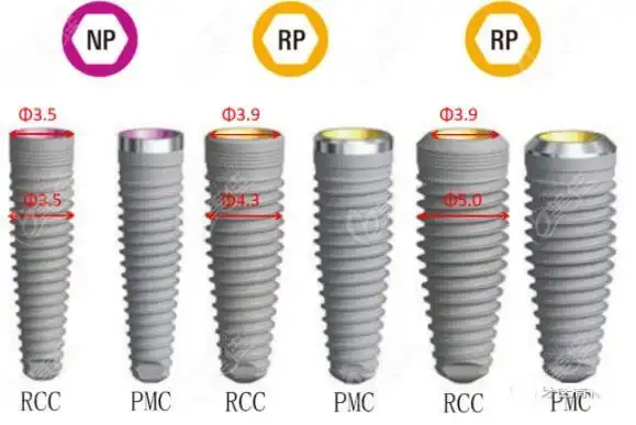 67详解nobelreplace的价格及优缺点破解诺贝尔replace种植体被淘汰