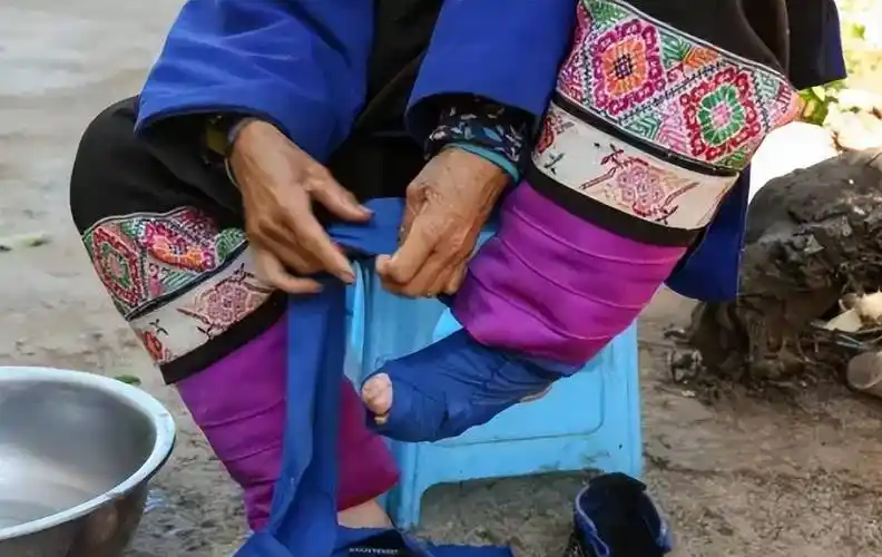 最后一位裹脚女性口述:15岁靠"三寸金莲"嫁大户,洗脚疼到崩溃