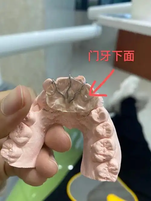 今天我认识了万恶的斜导变成了超级大舌头