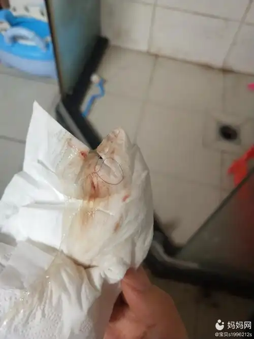 月经干净两天后 同房第二天上厕所擦出了这个怎么回事呢