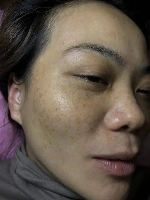 无创技术11天的蜕变过程?