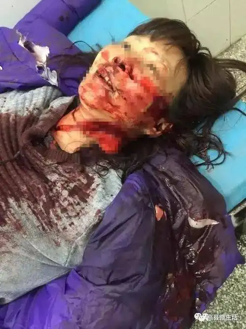 宜宾兴文县发生砍人事件!一男子当街追砍2人!